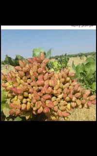 پیوند زنی برادران کریم آبادی