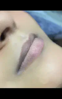 میکرو بلیدینگ و شیدینگ لب