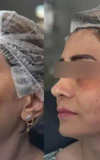 جراحی های زیبایی با مناسب ترین قیمت و کیفیت