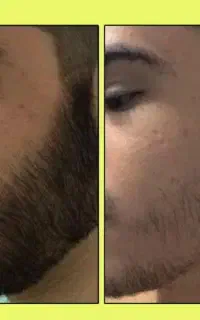 بازی در نیار ریش بزار