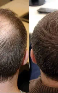 قبل از کاشت اینو ببین