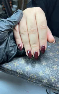 اف ویژه کاشت ناخون کاشت اولیه ۳۰۰