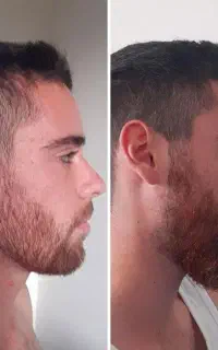 ریشی که آرزوشو داشتی