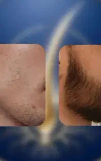 داداش تاکی میخوایی کم ریش باشی