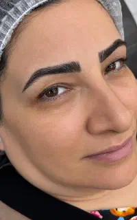 مدل میکروبلیدینگ