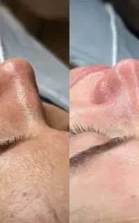پاکسازی پوست تخصصی