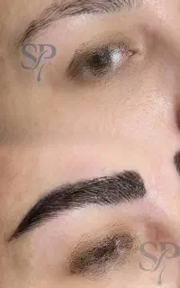 میکرو کاشت ابرو  با نتیجه و خواب طبیعی در شیراز