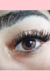آموزش کاشت هیدن ۴۵۰۰ موخوره گیری ۲۵۰۰