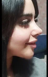 تخفیفات ویژه جراحی بینی تا پایان اردیبهشت ماه