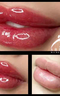 میکروبلیدینگ و شیدینگ لب با تخفیف ویژه