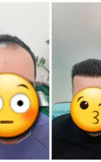 موهاتو قسطی بکار