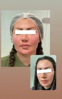 خدمات زیبایی درمانی تخصصی با کمترین هزینه