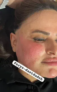 ژل فقط ۹۹۹کربن تراپی فقط۴۹۹ آنزیم ۵۹۹