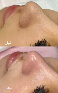 سالن زیبایی ملورین تمامی خدمات ۴۰ درصدتخفیف