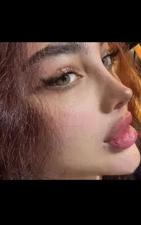 فیلربادی۱۵۰مزو،بوتاکس،انزیم.فول فیس،فیلر۵۵۰