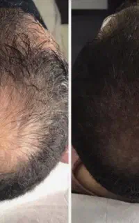 ظاهر زیباتر اعتماد به نفس بالاتر