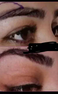 آف جراحی بینی ۲۰ت ولیپوساکشن وابدودراهواز