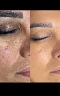 پوستت نیاز به یه بازسازی حرفه ای دار.