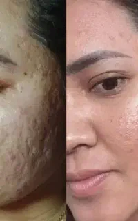 بیوممتیک(معجزه پوست)از نمایندگی اصلی