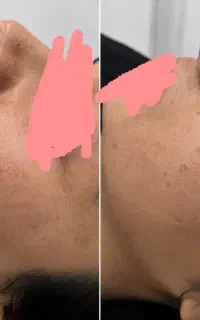پی ار پی ۹۰۰‌ ژل ۹۰۰