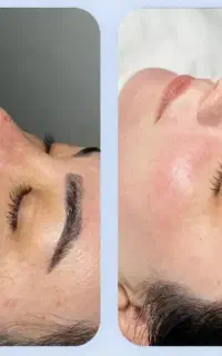 مزووایت سفیدی صورت