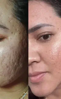انواع محصولات پوست و مو مارک آلمان و فرانسه