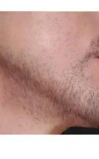 کاشت ممنوع