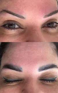 ریمووتخصصی ابروخط چشم تک جلسه ای با مواد رجووی