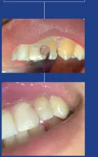 دندان پزشکی بدون درد واسترس در یزد