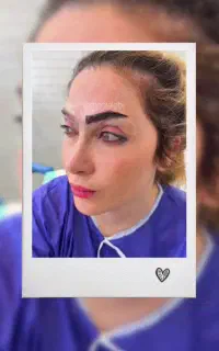 کاشت تخصصی ابرو به روش سوپرمیکروگرفت