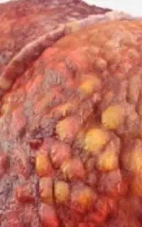 کبدت چرب ازداروهای شیمیای خسته شدی بیا راه کاربگیر