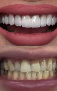 ونیرکامپوزیت لمینت اقساطی جشنواره کاریزما سارمکو