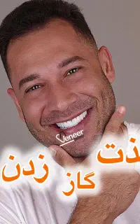 دندانپزشکی کامپوزیت لمینت ایمپلنت (اقساطی ۱ روزه)