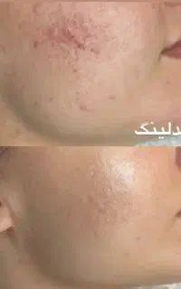 فیشیال عروس با پکیجینگ استثنائی در معتبرترین سالن