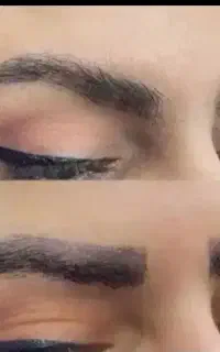 پاک کردن تاتو ابروخالکوبی قدیمی رنگی لیزرکیوسوئیچ