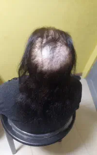 اکستنشن موی طبیعی