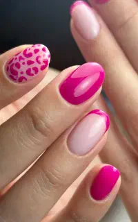 کاشت ناخن