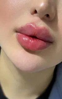 کلینیک زیبایی خدمات برااقایون وخانماازفیلرسیسی ۸۹۰