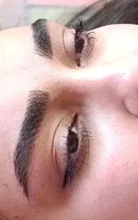 فیبروز.میکروبلیدینگ.میکروپیگمنتیشن.تخفیف برای عید