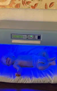 اجاره دستگاه زردی بیمارستانی