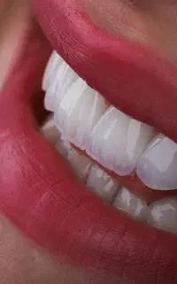 دندانپزشکی ارتودنسی ایمپلنت دیجیتال لمینت درمانی