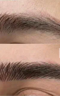 میکروبلیدینگ ابرو