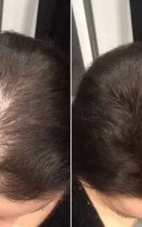 موهای پرپشت طبیعی