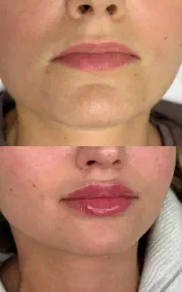 کلینیک زیبایی ژل فیلربادی نخ بوتاکس لیزرلاغری قسطی