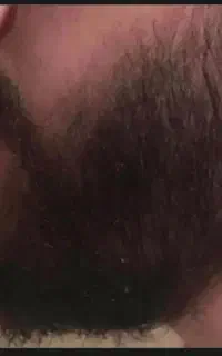 کاشت ممنوع