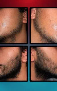 اگر سلامت مو و ریشات مهمه بیا سولوشن