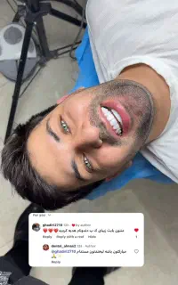 لبخند جذاب /دنتال الماس
