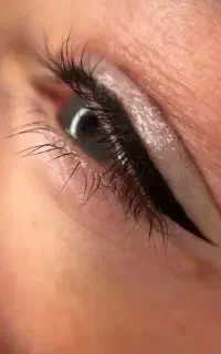 آموزش فیبروز میکرو شید/60درصد تخفیف/مطب زیبایی