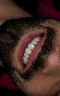 کامپوزیت ونیر طبیعی/ لبه شیشه ای /باضمانت