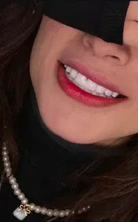جشنواره تخفیف ویژه کامپوزیت